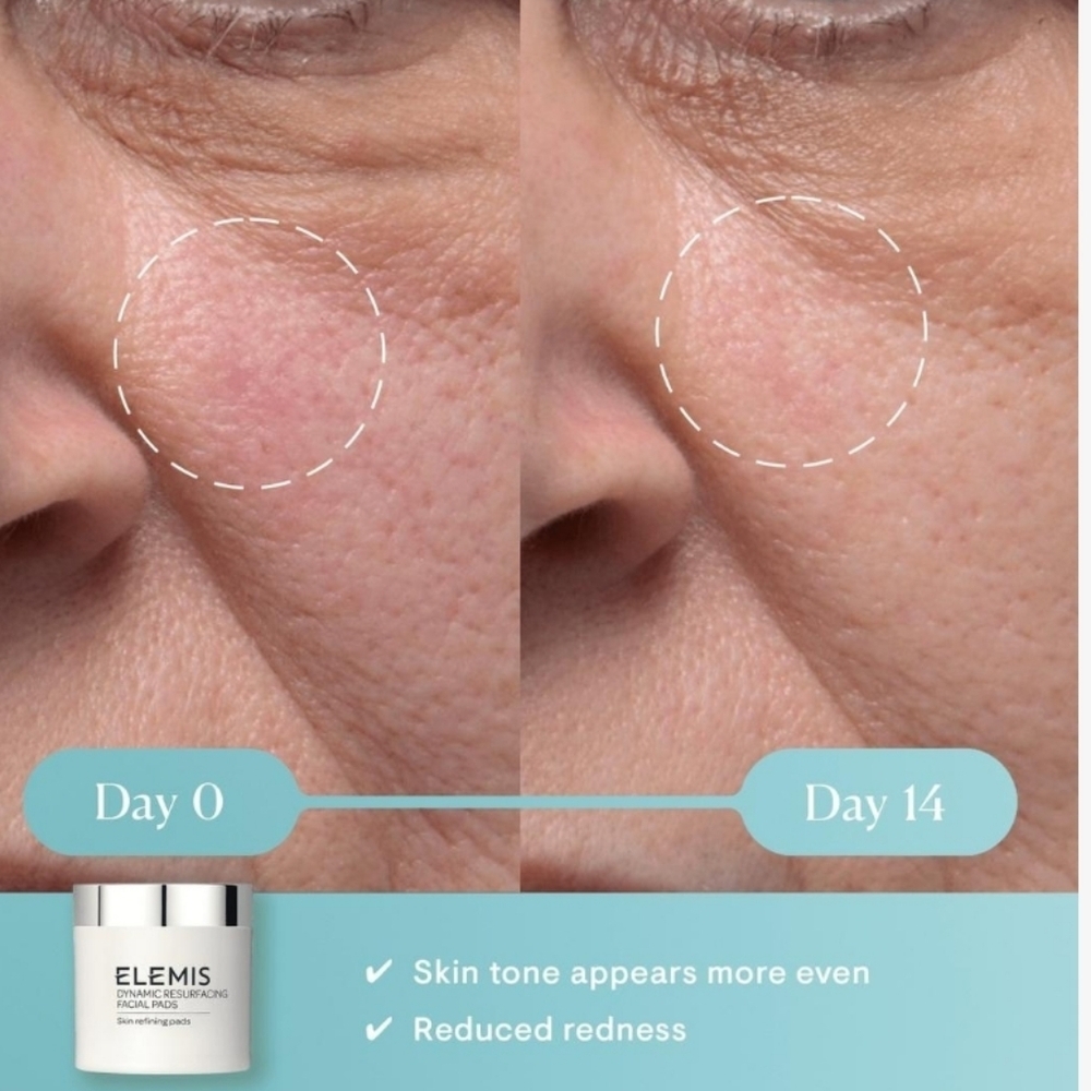Elemis Dynamic Resurfacing Facial Pads, 14 Count, New - Picture 4 of 8